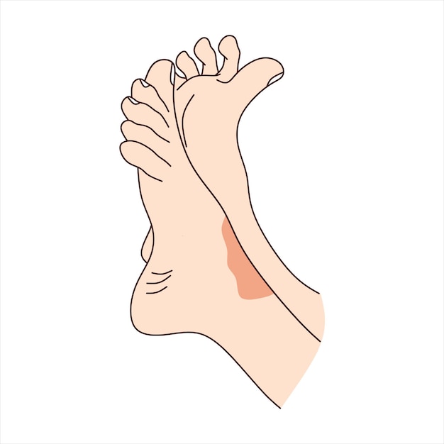 Voeten met huiduitslag psoriasis