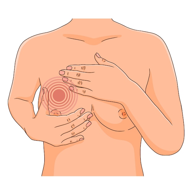 Vector vrouw die maandelijkse borstcontrole uitvoert op tumor en knobbel kanker zelfexamen vectorillustratie een deel van de vrouwelijke torso met overhandigt de borsten realistische stijl