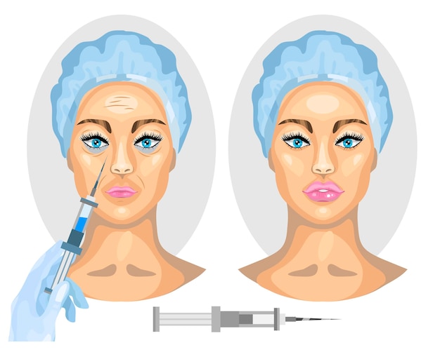 Vrouw gezicht voor en na Botox injectie Vector