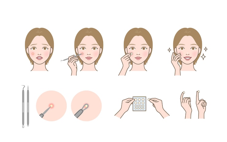 Vector vrouw karakter extracten en verwijdert whitehead zit acne met puistje potter gereedschap en probleem patch