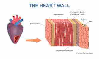 Vector wall heart structure