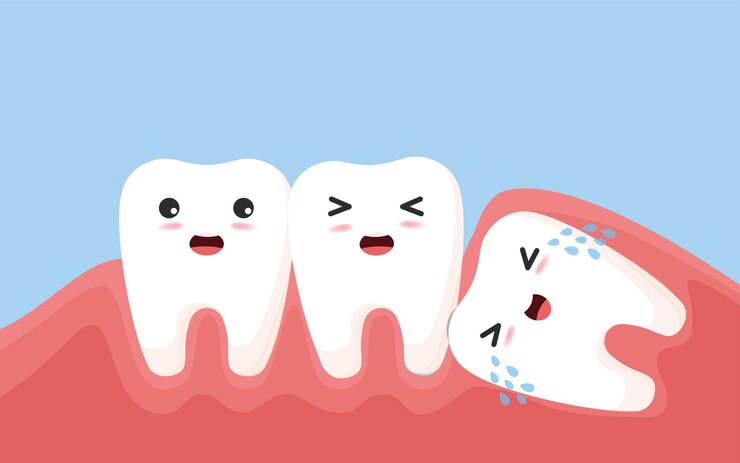 Vector 사랑니는 다른 치아를 밀어냅니다. 염증, 치통, 잇몸 통증을 유발하는 인접한 치아를 밀어내는 영향을받은 사랑니 캐릭터. 삽화