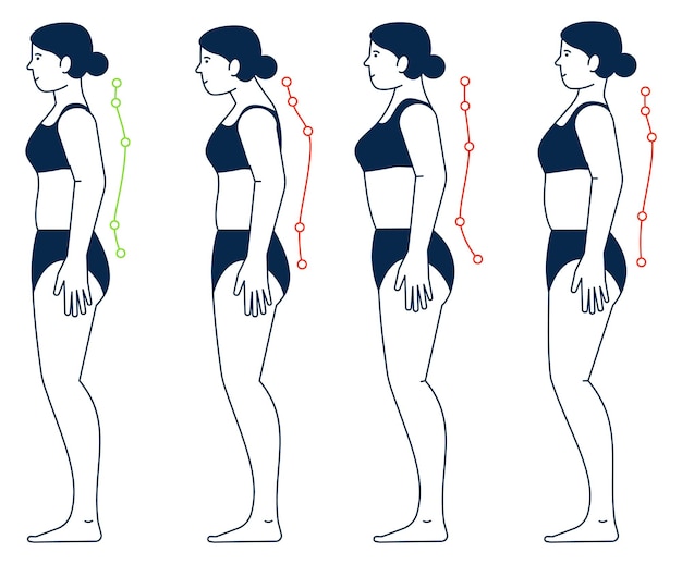 Vettore vista laterale della correzione della schiena della donna posture sbagliate e corrette