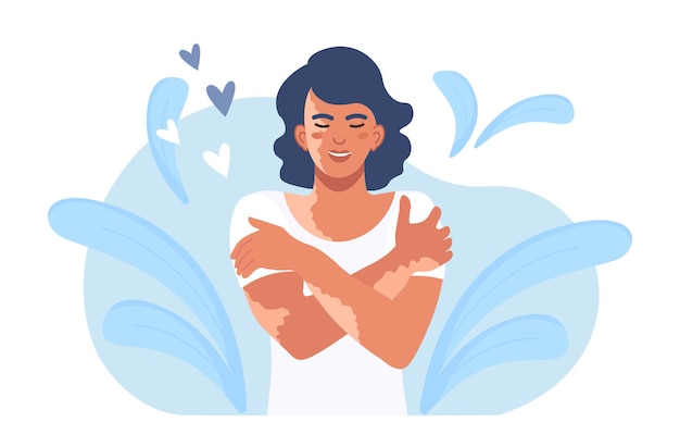 Vector woman hugging herself with skin problems, disease. happy girl with vitiligo hugs herself by the shoulders. world vitiligo day. person loves her body. self care and self love