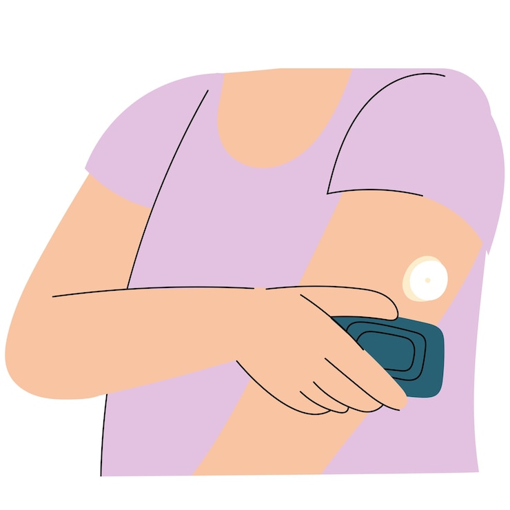 Vector woman wearing a wearable blood sugar monitor diabetes management and health technology