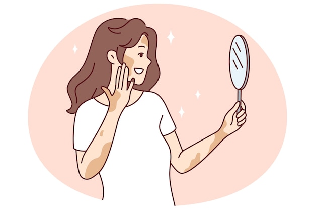 Vector woman with vitiligo look in mirror