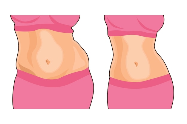 Vector women's weight loss before after