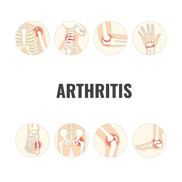 Vettore giornata mondiale dell'artrite