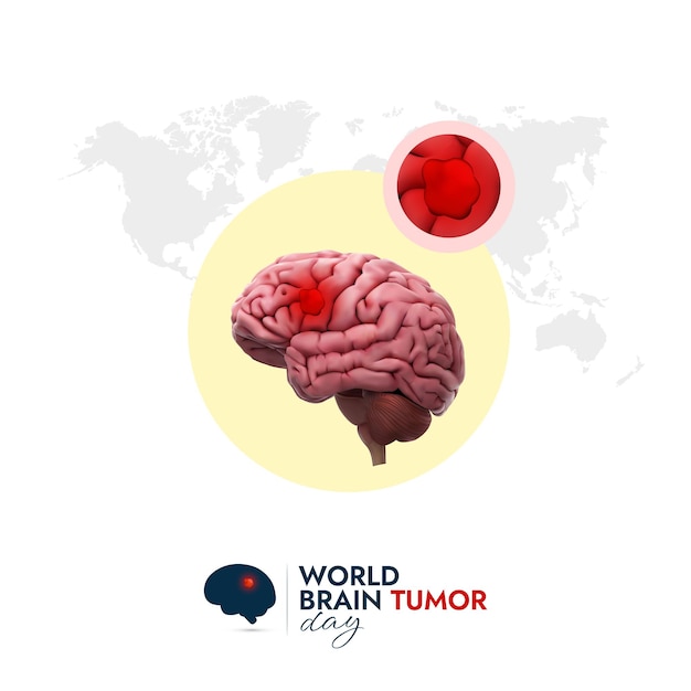 世界脳腫瘍デーは脳腫瘍についての認識を広め、人々を教育するためのデザイン