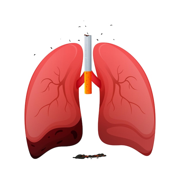 世界禁煙デー不健康な肺ベクトル設計図