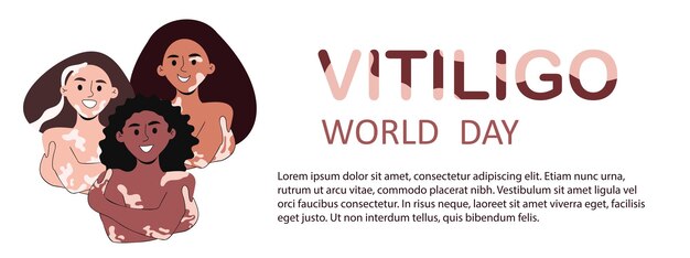 벡터 세계 vitiligo의 날 배경 템플릿 벡터 일러스트 레이 션