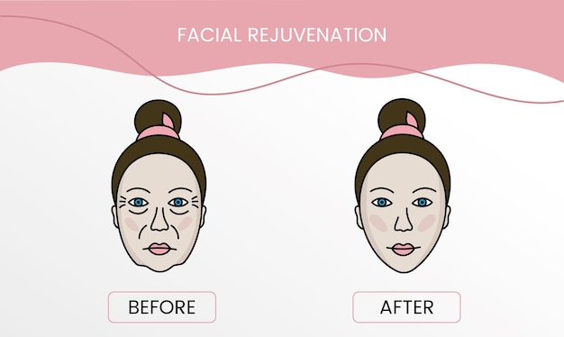 ベクトルでの治療前と治療後の顔のレーザー美容のしわ滑らかできれいな肌と問題のある肌を持つ女性のイラスト