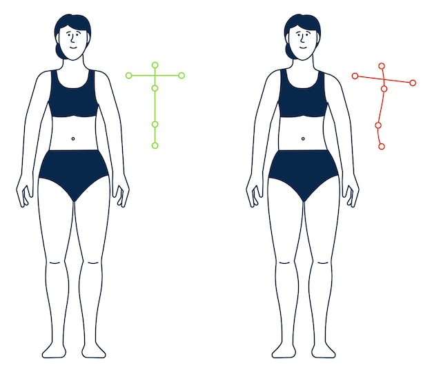 Postura del corpo sbagliata e corretta allineamento della colonna vertebrale della donna