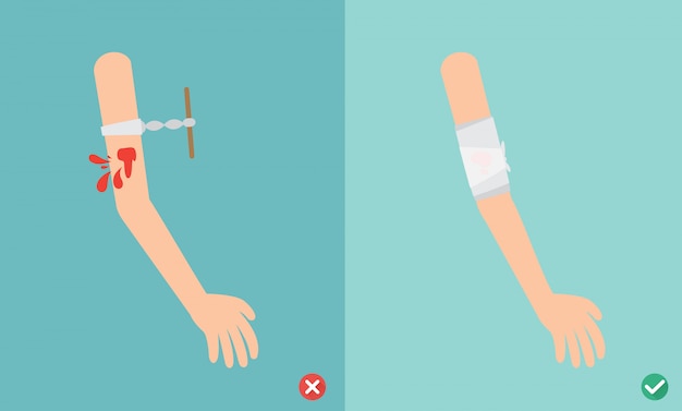 Vettore trattamento di emergenza del pronto soccorso sbagliato e giusto, illustrazione