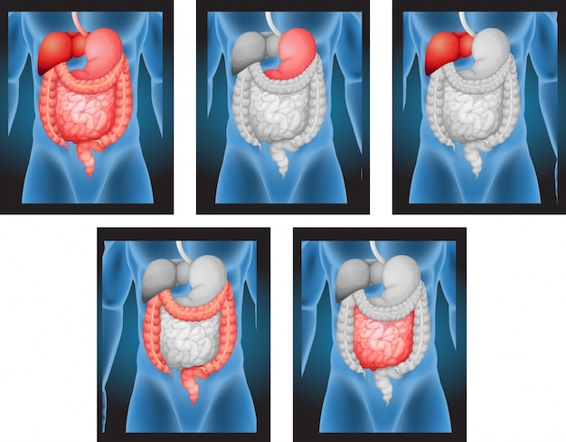 X-ray films of human organs illustration