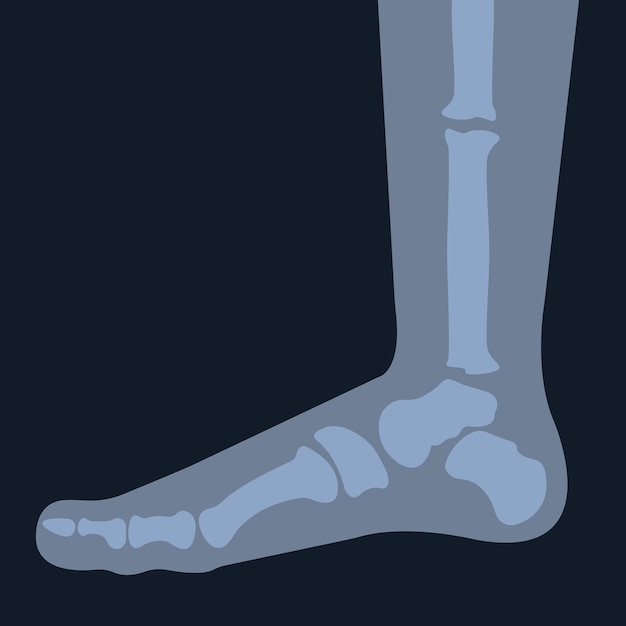 Vettore radiografia dello scheletro del piede. ossa della gamba umana. anatomia articolare