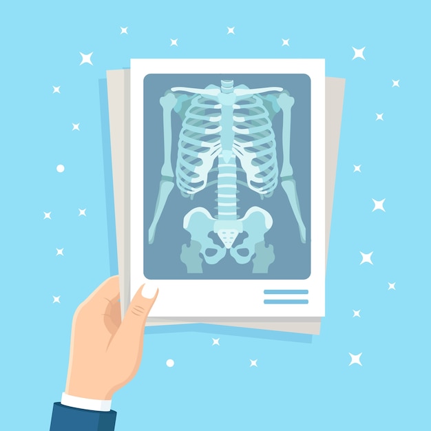 Vector x-ray shot of human body in hand. roentgen of chest bone. medical examination for surgery