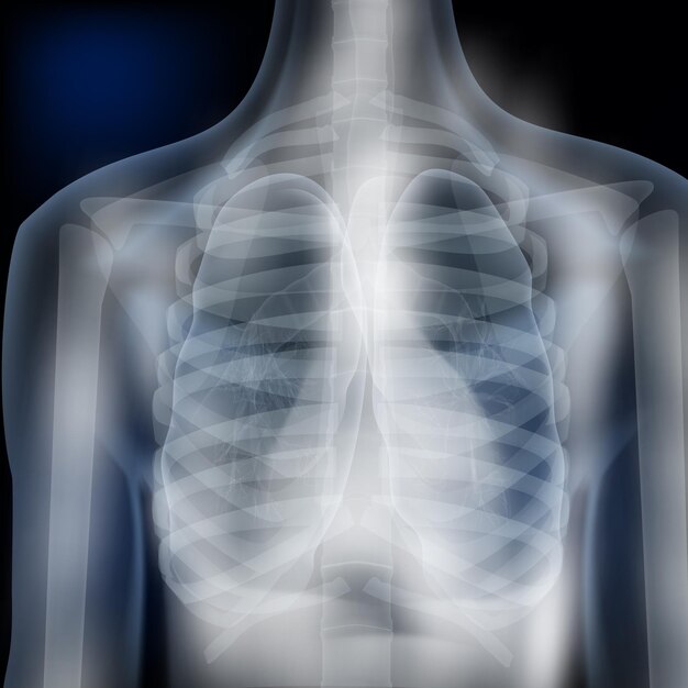 Vector xray image of human chest medical diagnosis