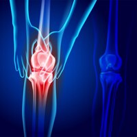 暗い青色の背景に膝関節損傷を示す膝を保持している 2 つの手の x 線画像