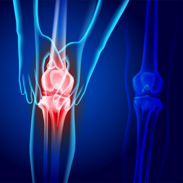 Xray image of two hands holding knee showing knee joint injury on dark blue background