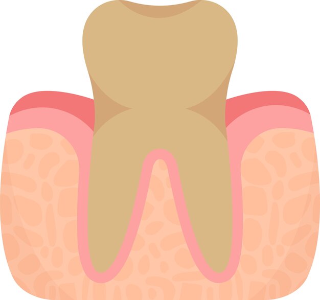 Yellow tooth problem