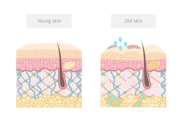 젊고 오래된 피부