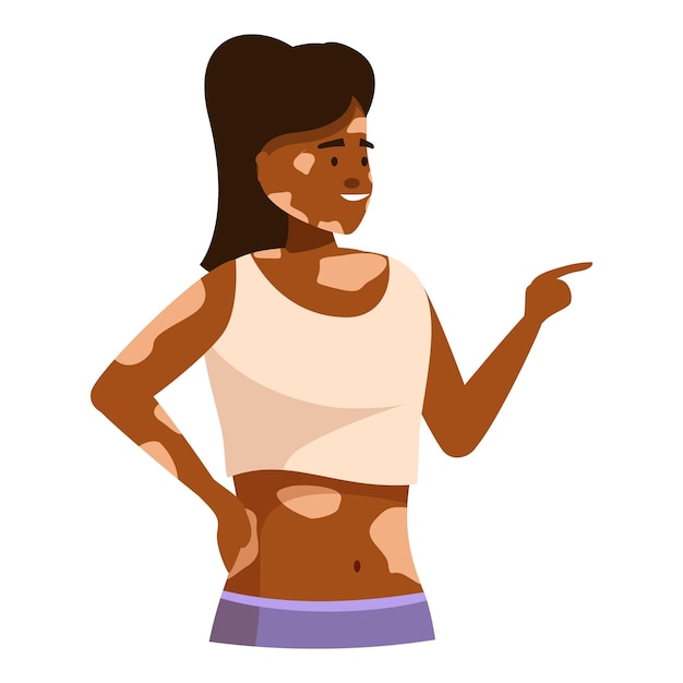 young smiling woman with vitiligo is pointing with her finger