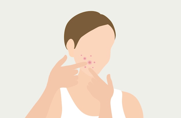 Vector young woman face with skin acne pimples blackheads vector illustration acne skin face problem