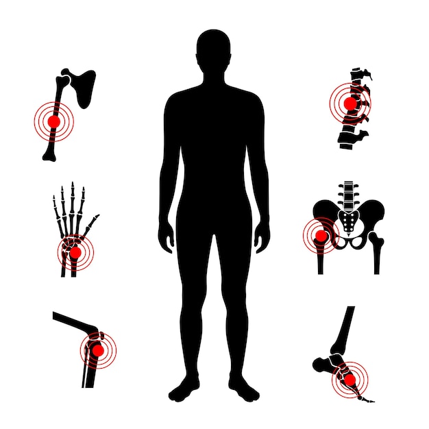 Vector ziekte van menselijke botten en gewrichten ontstoken wervelkolom, arm, been en heup traumablessure, infectie of fracturen in het mannelijke silhouet onderzoek van het menselijk lichaam chirurgie en behandeling medische vector