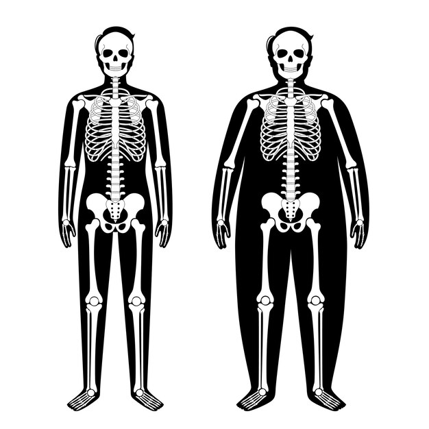 Vector zwaarlijvige skelet anatomie