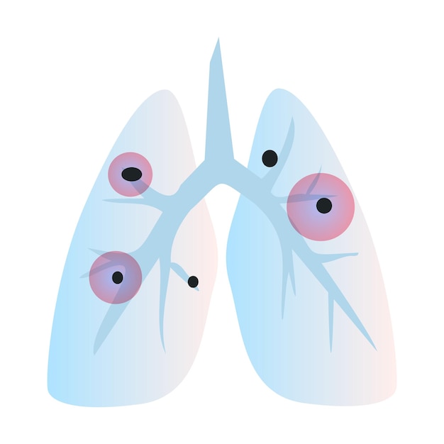 Vector zwarte giftige schimmels schimmel sporen in de longen van de mens allergene zwarte meeldauw vlekken donkere schimmel kolonies geïsoleerd platte vectorillustratie geïsoleerd op witte achtergrond