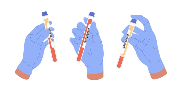 Hand holding blood tests tubes set on white background Plasma blood in vitro