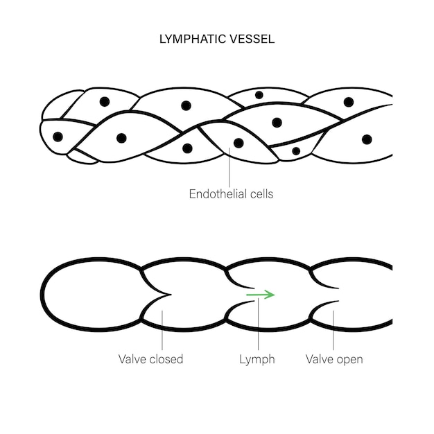 Lymphatic vessel concept
