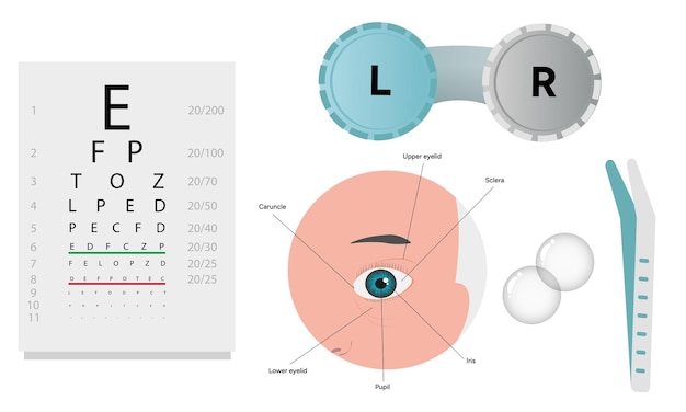 ophthalmology oculist set vision correction eye anatomy with exam table