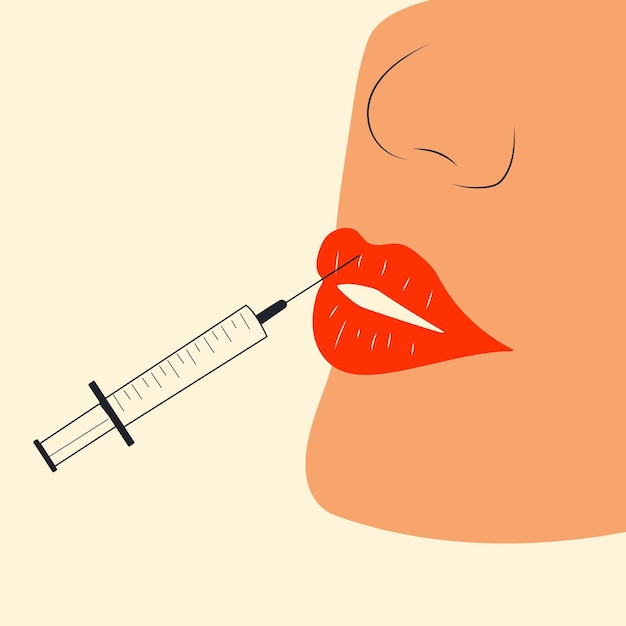 lips injection, lip augmentation. injectable cosmetic filler. vector illustration in cartoon style