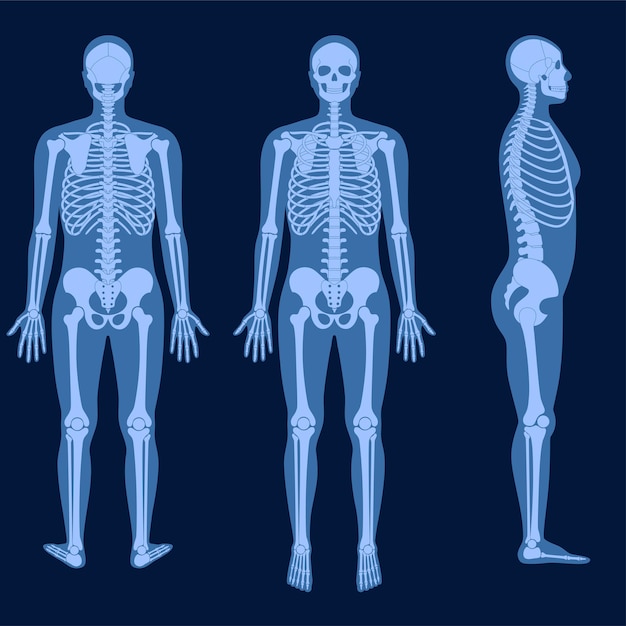 Anatomia Szkieletu Człowieka Z Przodu, Z Profilu I Z Tyłu Na Ilustracji Wektorowych Promieniowania Rentgenowskiego