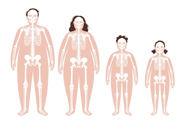 Plik wektorowy anatomia szkieletu otyłego