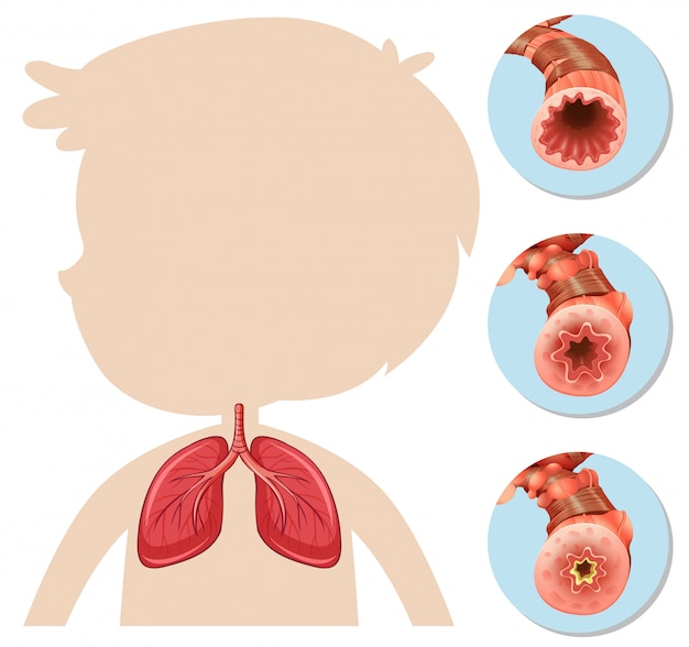 Plik wektorowy anatomy of boy silhouette lung