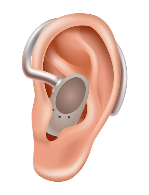 Plik wektorowy aparat słuchowy wzmacniacz dźwięku dla pacjentów z ubytkiem słuchu medycyna i zdrowie realistyczny obiekt za uchem leczenie i protetyka w otolaryngologii