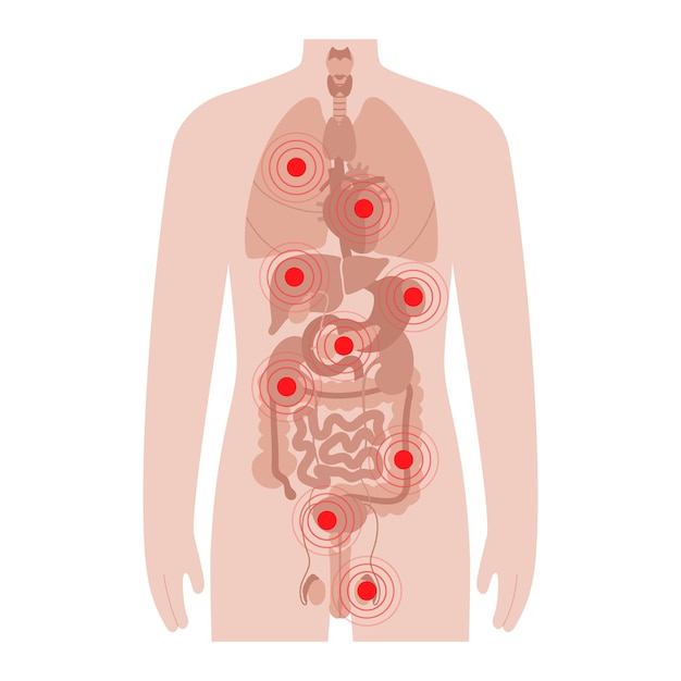 Plik wektorowy ból w męskim ciele