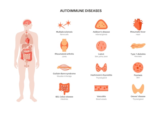 Choroby Autoimmunologiczne