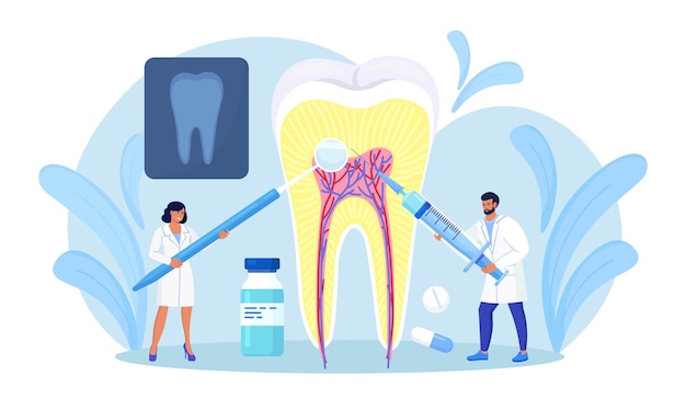 Plik wektorowy dentyści oczyszczający i leczący duży niezdrowy ząb z próchnicą. ból zęba. stomatologia, koncepcja stomatologii. lekarze z profesjonalnymi instrumentami do kontroli i leczenia. wizyta u dentysty