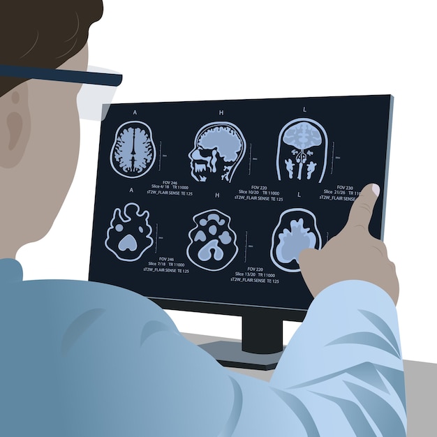 Plik wektorowy diagnoza chorób mózgu u lekarza badającego obrazowanie metodą rezonansu magnetycznego (mri) diagnoza