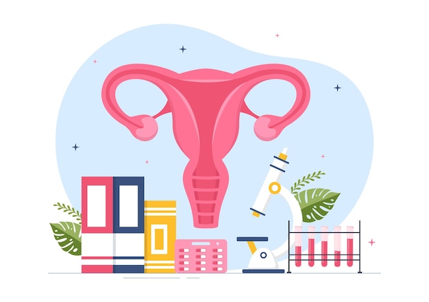 Plik wektorowy endometrioza ze stanem endometrium rośnie poza ścianą macicy u kobiet w ilustracji