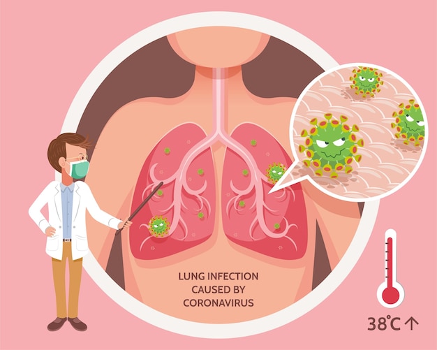 Ilustracja Infekcji Płuc