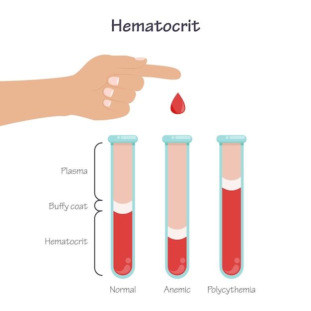 Plik wektorowy ilustracja wektorowa badania krwi hematocrytu grafika medyczna