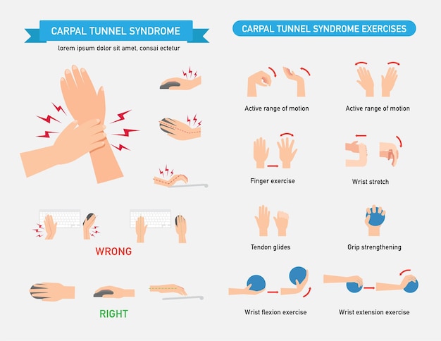 Plik wektorowy ilustracja wektorowa infograficzna zespołu tunelu nadgarstkowego