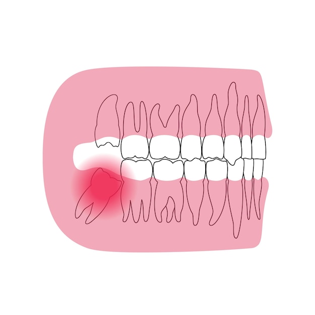 Plik wektorowy ilustracja wektorowa na białym tle uzębienie stałe ludzkie zęby. górna i dolna szczęka.