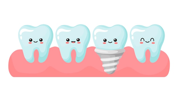 Implant I Zdrowe Zęby. Słodkie Zęby Kawaii. Ilustracji Wektorowych W Stylu Kreskówki.