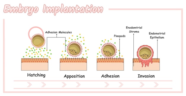Plik wektorowy implantacja zarodka